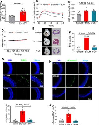 FGF4, A New Potential Regulator in Gestational Diabetes Mellitus